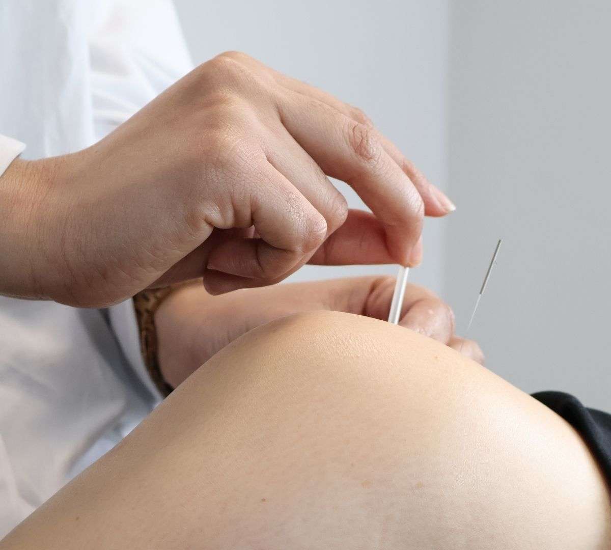 acupuncture for knee pain Physiotherapy treatment in Sutton Coldfield clinic